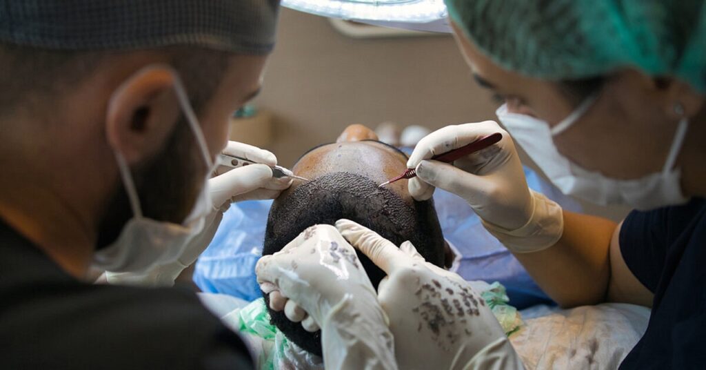 Hair Transplant Jersey City New Jersey