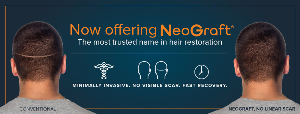 Hair Transplant St. Petersburg Florida Hair Transplant St. Petersburg Florida