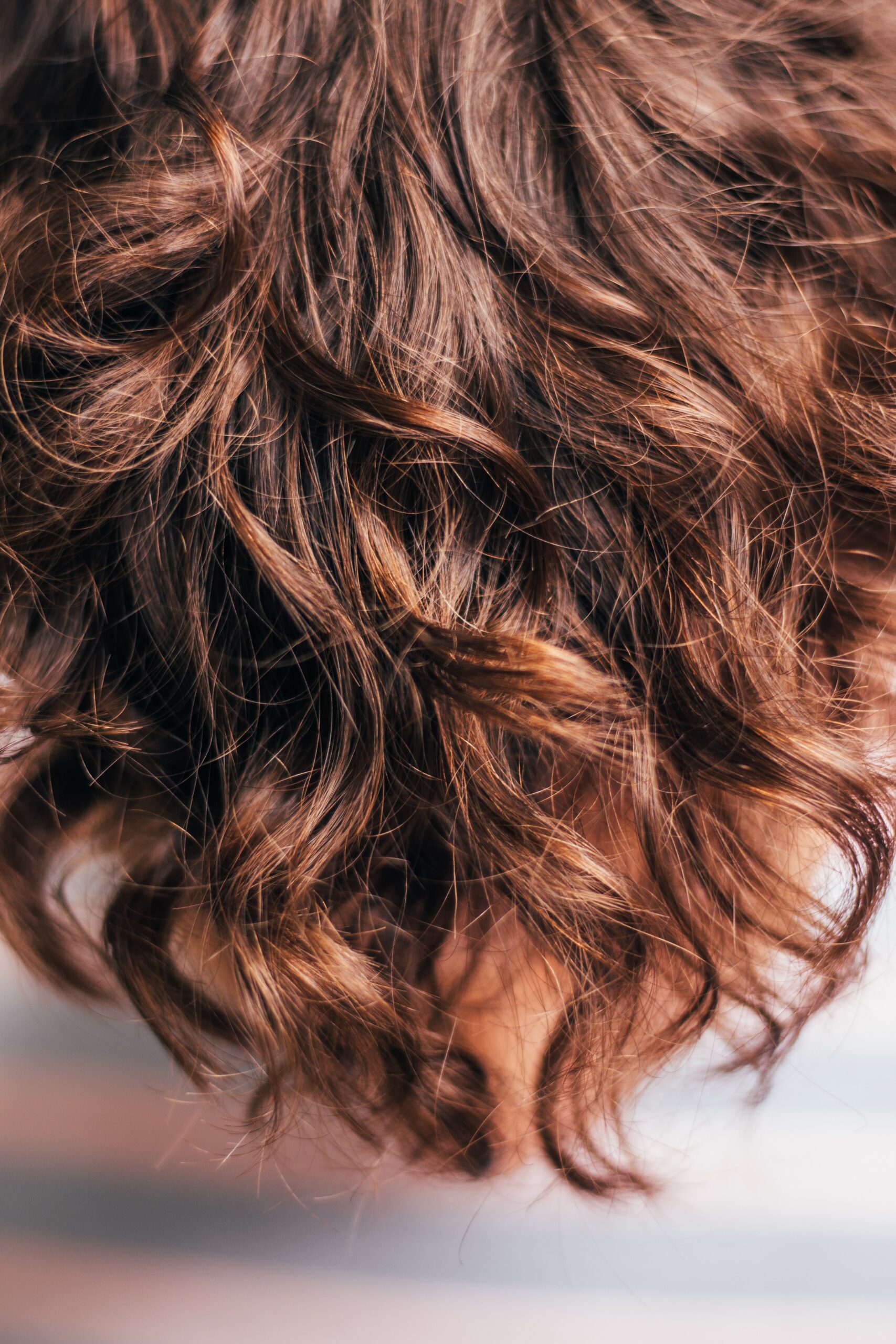 Hair Transplant Barnstable Town Massachusetts