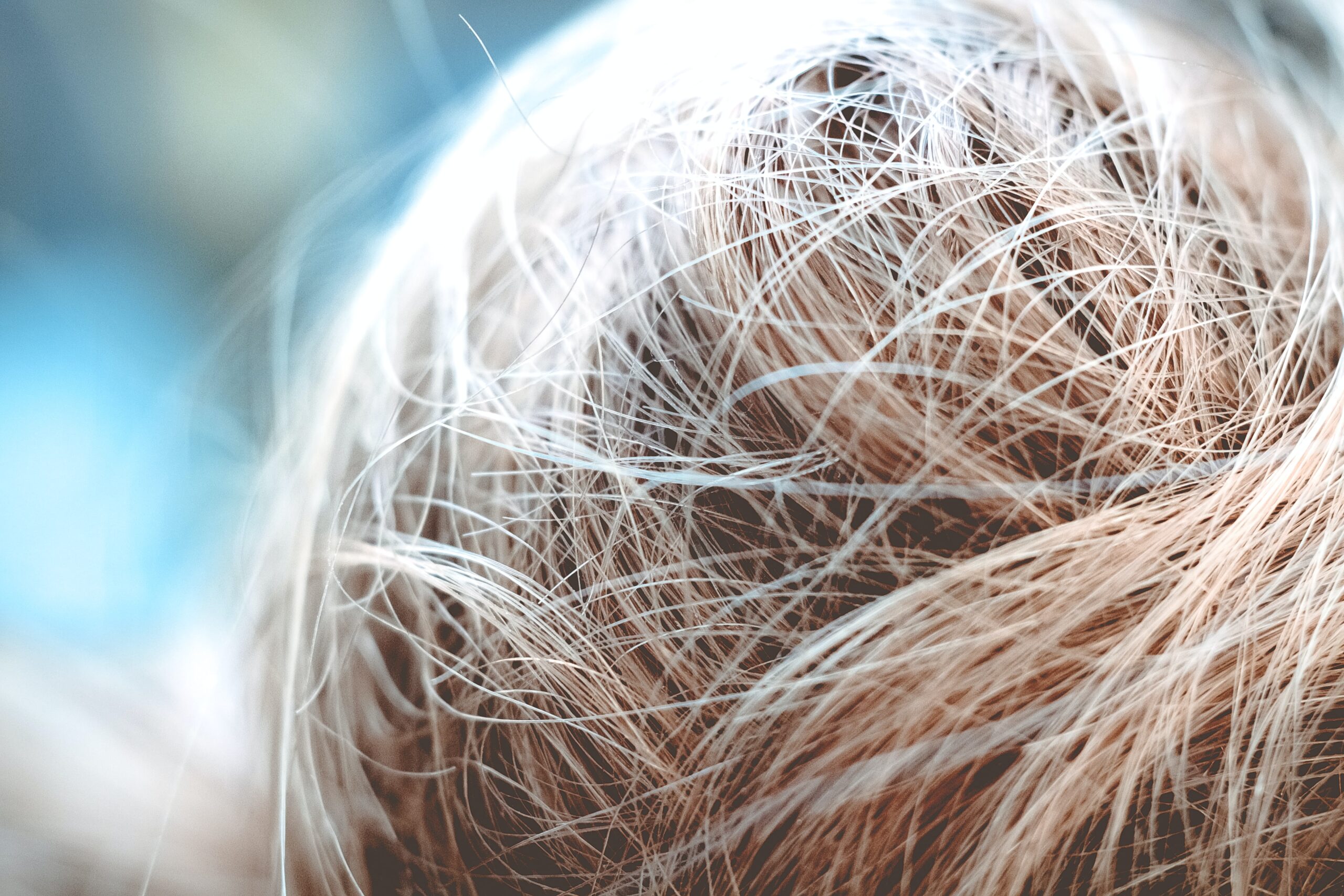 Hair Transplant Maple Grove Minnesota Hair Transplant Maple Grove Minnesota
