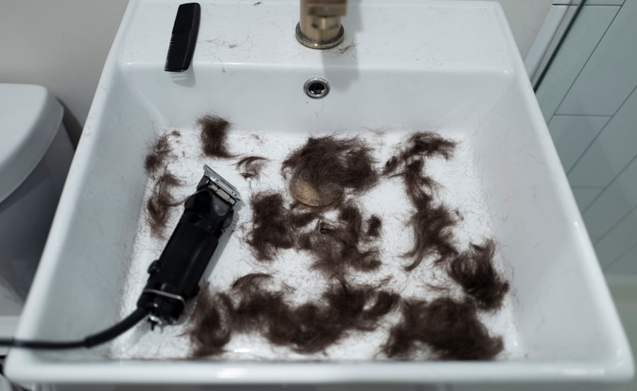 Hair Transplant
