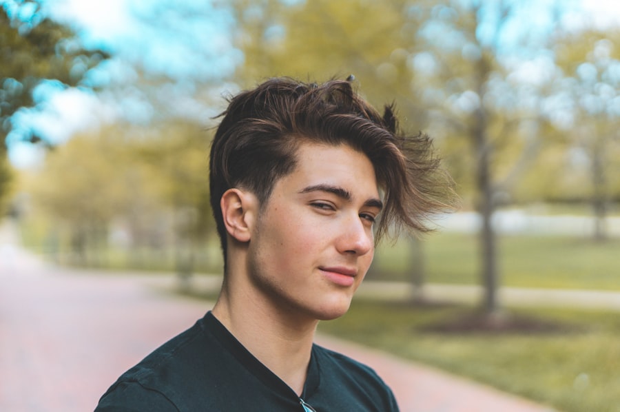 Photo Hair Transplant Results